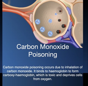 Carbon Monoxide Poisoning