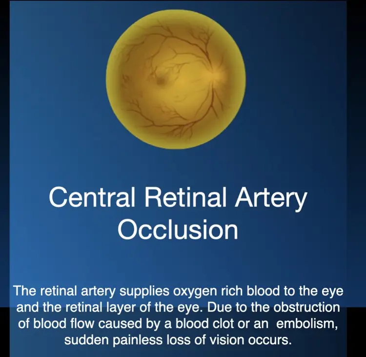 Hyperbaric oxygen therapy for central retinal artery occlusion