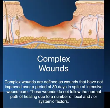 Hyperbaric oxygen therapy for complex non-healing wounds