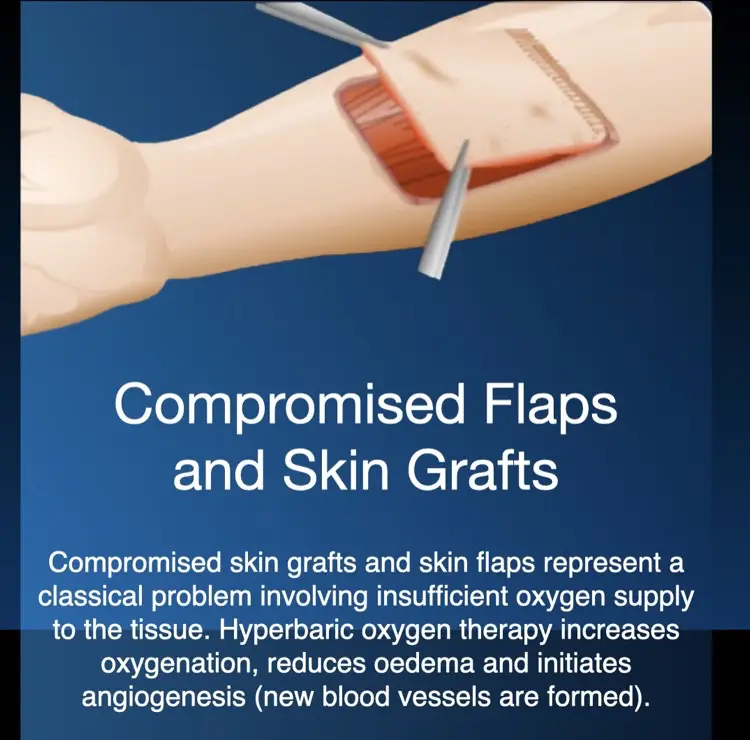 Hyperbaric oxygen therapy for compromised grafts and flaps