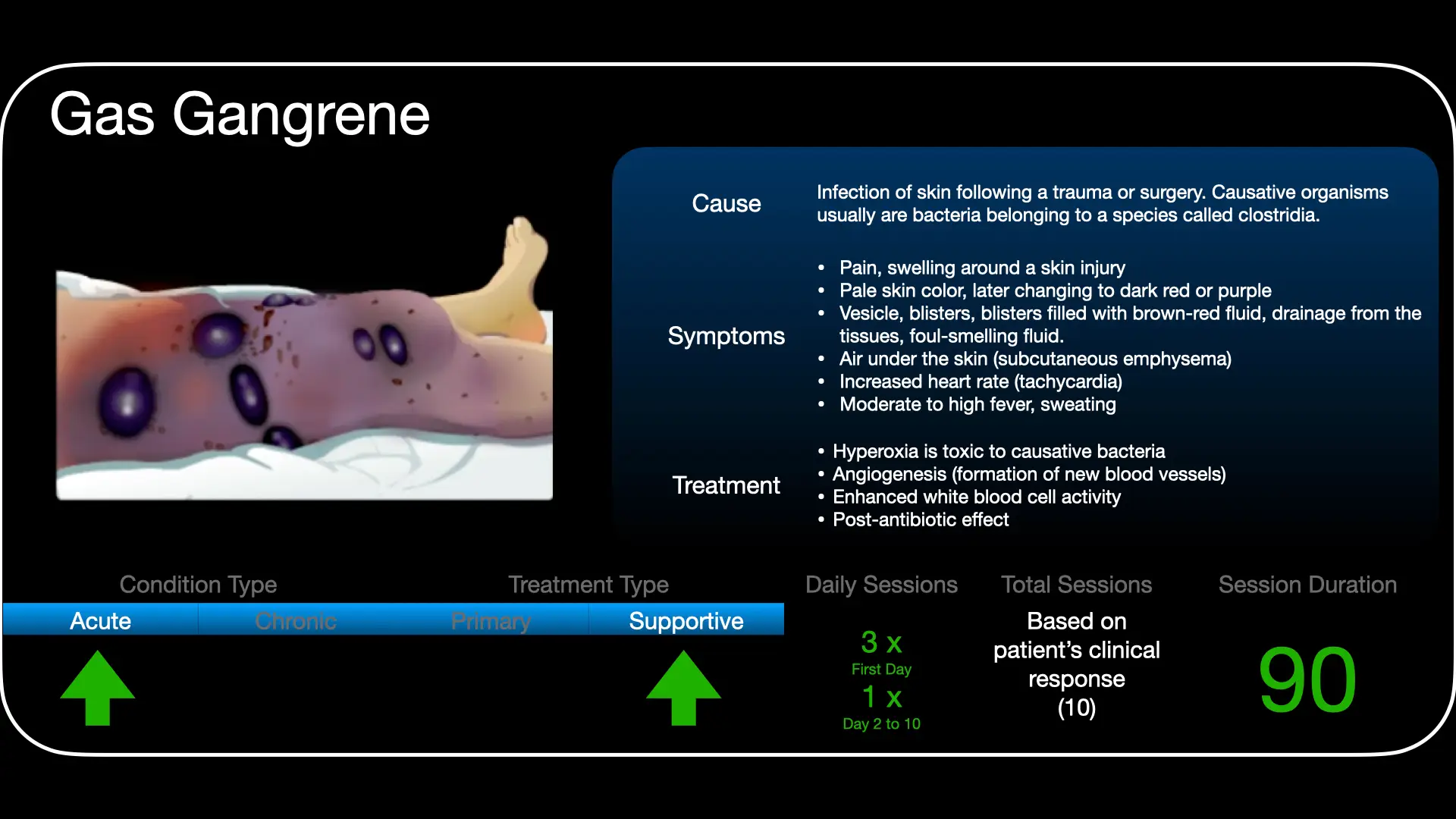 Treatment approach for hyperbaric oxygen therapy in gas gangrene