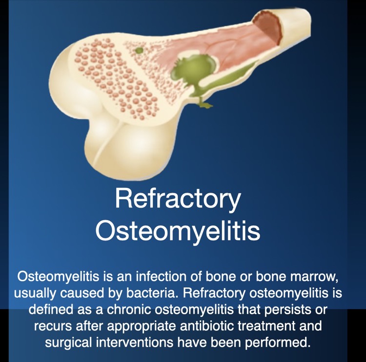 Osteomyelitis.jpeg